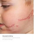 Scar removal - Photo before - Bieńkowscy Clinic®