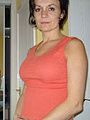 Breast Augmentation - Breast Implants - Photo before - The Hospital Group