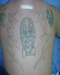 Eliminacion de tatuajes - Foto Antes de - Dr. Aristides Arellano-Huacuja
