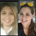 Liposucción - Foto Antes de - Dr. Marco Antonio Carmona M.D.