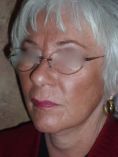 Facelift - Photo before - Matthew M. Akers, MD