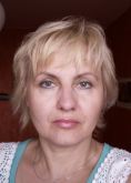 Eyelid surgery (Blepharoplasty) - Photo before - Klinika Laser Esthetic