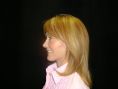 Facelift - Photo before - Boris Volshteyn MD