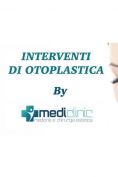 Otoplastica mini invasiva - Foto del prima - Dott. Salvatore Scandura M.D.