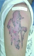 Eliminacion de tatuajes - Foto Antes de - Dr. Aristides Arellano-Huacuja