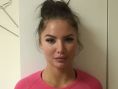 Lippenvergrößerung - Vorher Foto - Beauty Studio Dana