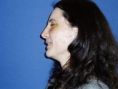 Rhinoplasty (Nose Job) - Photo before - Klinika Laser Esthetic