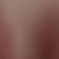 Breast Augmentation - Breast Implants - Age: 20 – 25 year old female. Photos taken 3 months post operation