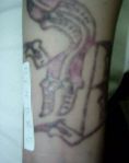 Eliminacion de tatuajes - Foto Antes de - Dr. Aristides Arellano-Huacuja