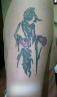 Eliminacion de tatuajes - Foto Antes de - Dr. Aristides Arellano-Huacuja