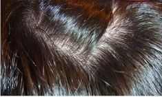 Haartransplantation - Vorher Foto - Prohaarklinik