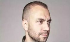 Haartransplantation - Vorher Foto - Prohaarklinik