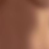 Laser hair removal - Photo before - Klinika Laser Esthetic