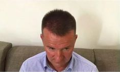Haartransplantation - Vorher Foto - Prohaarklinik