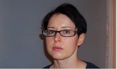 Haartransplantation - Vorher Foto - Prohaarklinik