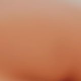 Labiaplasty (Labia Reduction) - Photo before - Dr n. med. Marcin Bieńkowski