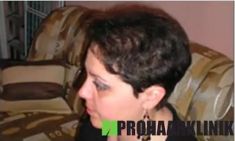 Haartransplantation - Vorher Foto - Prohaarklinik