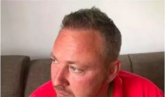 Haartransplantation - Vorher Foto - Prohaarklinik