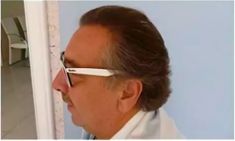 Haartransplantation - Vorher Foto - Prohaarklinik