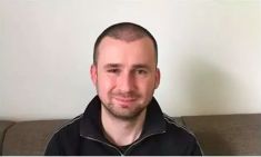 Haartransplantation - Vorher Foto - Prohaarklinik