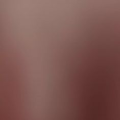 Breast Augmentation - Breast Implants - Photo before - M.D., F.A.C.S. Bernard A. Shuster