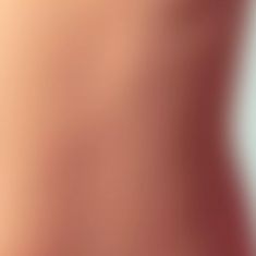 Breast Augmentation - Breast Implants - Photo before - ARS ESTETICA – Klinika Medycyny Estetycznej i Laseroterapii