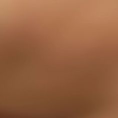 Breast Augmentation - Breast Implants - Photo before - Klinika Laser Esthetic
