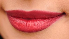 Lippenkorrektur Lippenspalte Estheticon De