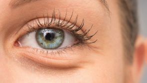 Wirksam Augenringe Entfernen Blepharoplastik Laser Oder Hyaluronsaure Estheticon De