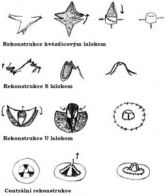 rekonstrukce-prsu-eva-z