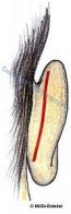 ucho-uzavreny