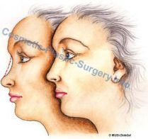 propadly-nos-profil
