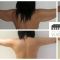 Lifting des bras