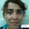Lifting facial APTOS