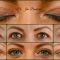 Operácia očných viečok (Blepharoplastika)