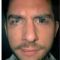 Rhinoplastie secondaire