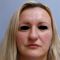 Plastika nosu (Rhinoplastika)