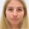 Plastika nosu (Rhinoplastika)