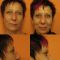 Rhinoplastie