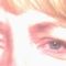Eyelid surgery (Blepharoplasty)