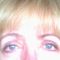 Eyelid surgery (Blepharoplasty)