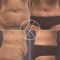 Abdominoplastika (Operace břicha)
