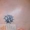 Tattoo removal
