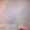 Tattoo removal