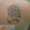 Tattoo removal