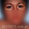 Korekcja powiek (Blepharoplastyka)