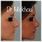 Rhinoplastie