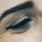 BOTOX®