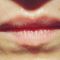 Lip augmentation - cheiloplasty