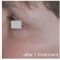 Botulinum toxin - Wrinkle Removal